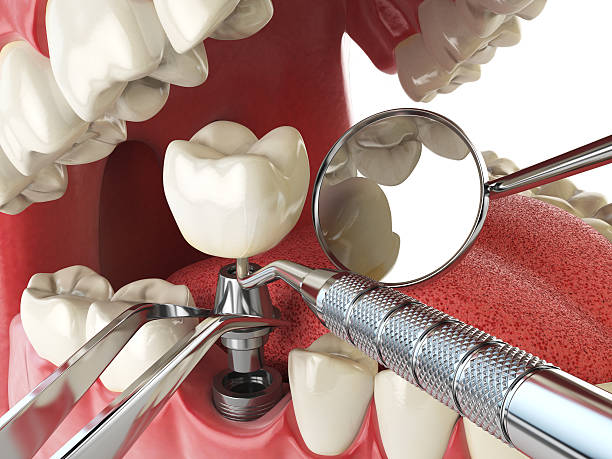 Best Emergency Wisdom Tooth Extraction in Mount Oliver, PA
